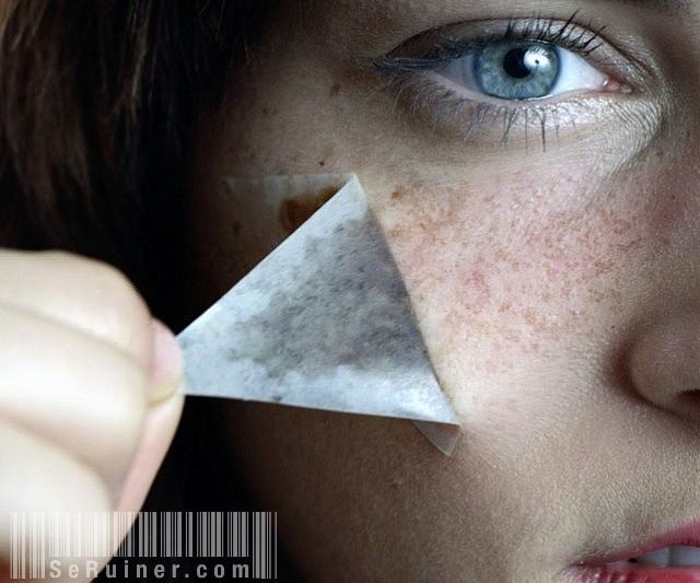 freckle-costmetic-kit-640x533